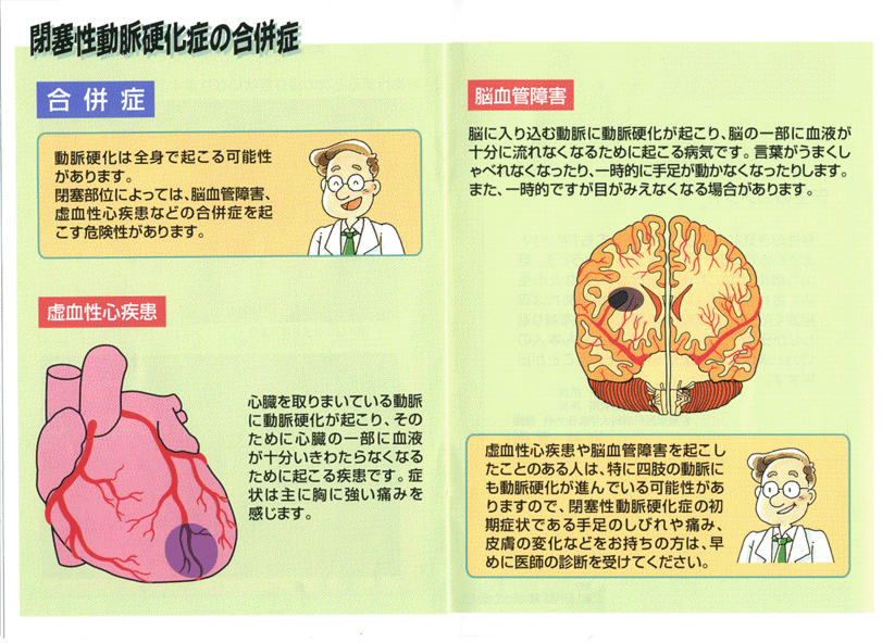 閉塞性動脈硬化症の合併症