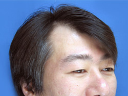 クィックＰＯＮⅡは男性