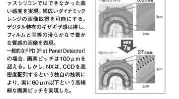 モノクロCCDの採用シンチレーターの波長域に特化した専用モノクロCCDが、アモルファスシリコンではできなかった高い感度を実現。幅広いダイナミックレンジの画像取得を可能にする。デジタル特有のギザギザ感は排し、フィルムと同等の滑らかなで豊かな質感の画像を表現。一般的なFPD （Flat  Panel Detector）の場合、画素ピッチは100μmを超える。しかし、NXは、CCDを高密度配列するという独自の技術により、実に60μm以下という高精細な画素ピッチを実現した。