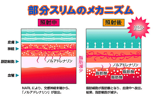 ナール、ナール超音波、ナールレボリューションスリムの三輪