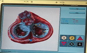 心臓の波動測定で病名を検査